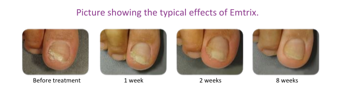 Mycosan Fungal Nail Treatment & Camoflague | Meaghers Pharmacy